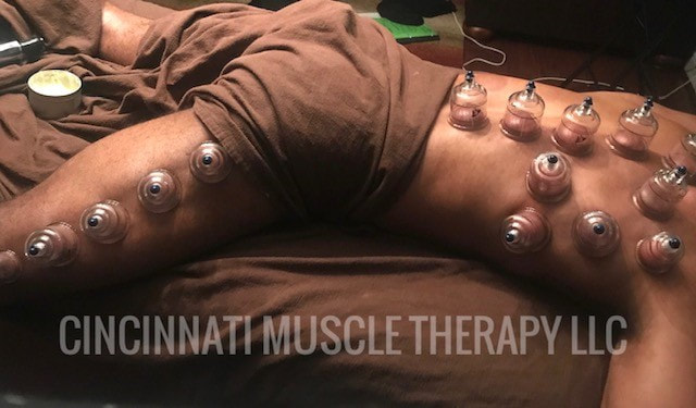 Cupping Therapy on Professional Athlete Recovery Day